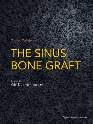 cover image of The Sinus Bone Graft